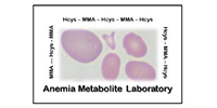 Anemia-Metabolite-Labs-Logo